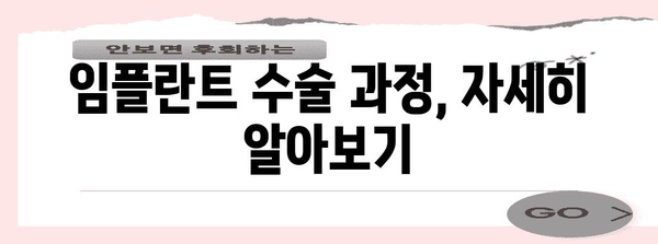 임플란트 Q&A | 종류, 가격, 과정, 관리법 총 정리