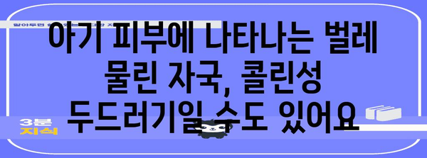 아기 피부에 무는 벌레 | 콜린성 두드러기의 원인과 치료법